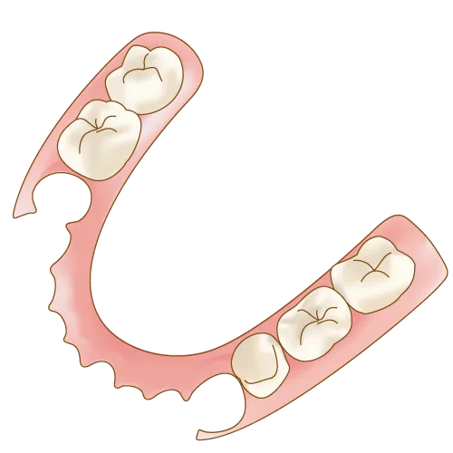 ノンクラスプデンチャー（スマイルデンチャー）